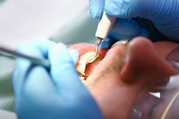 Best Dentist for Tooth Abscess  in Chicopee, MA